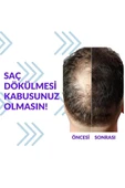 Pak Darou Minioxidil Minoxidil %5 Minoksil Pak Darou 2 ADET thumbnail 1