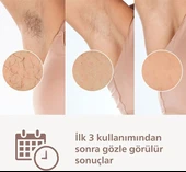 Philips Lumea Prestige Ipl Tüy Alma Cihazı + Vücut Ve Yüz Başlığı Brı950/00 Beyaz thumbnail 3