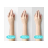 Yui IPLV16 Pro Buz Başlıklı Lazer Epilasyon Aleti thumbnail 2