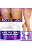 STİL KÖŞESİ Süper Maximum Strength Varicose Veins Krem 100 ml 1 Adt thumbnail 2
