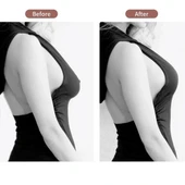 Göğüs Dikleştirme Bandı S Beden 2.5 Cm. thumbnail 2