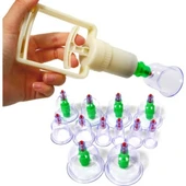 Hacamat Kupa Seti 6 Adet thumbnail 4