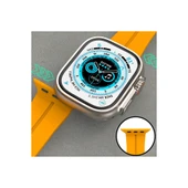 Apple Watch 38mm Kr412 Elegance Stylısh Kordon - Siyah thumbnail 6