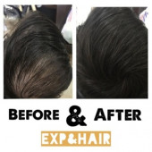 EXP&HAIR Saç Dolgunlaştırıcı Toz - 7