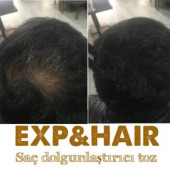EXP&HAIR PREMIUM SAÇ DOLGUNLAŞTIRICI TOZ - 8