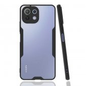 Xiaomi Mi 11 Lite Kılıf Kamera Korumalı Arkası Şeffaf Silikon - 8