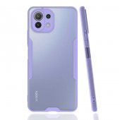 Xiaomi Mi 11 Lite Kılıf Kamera Korumalı Arkası Şeffaf Silikon - 11