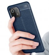 Xiaomi Mi 11 Lite Kılıf Niss Antişok Korumalı Deri Silikon Kapak - 4