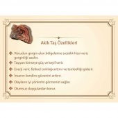 Nipora Hem Bileklik - Hem Kolye - Hem Tesbih 99lu Kırmızı Akik Doğaltaş Aksesuar - 7