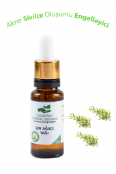 Akne ve Sivilce Oluşumunu Engelleyici Çay Ağacı Yağı Doğal ve Saf 20 ml - 1