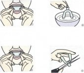 Diş Gıcırdatma Gece Plağı Ağızlık Diş Koruyucu Diş Sıkma Bruksizm Silikon Uyku Diş - 5