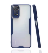 Xiaomi Redmi Note 11 Global Kılıf Parfe Kenarları Pastel Renk thumbnail 4