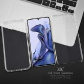 Xiaomi Redmi Note 11 360 Derece Şeffaf Silikon Kılıf Komple Koruma - 3