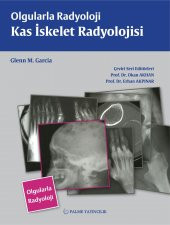 OLGULARLA RADYOLOJİ KAS İSKELET RADYOLOJİ (PALME) - 2