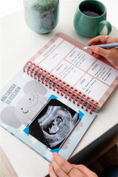 Bebek Anı Defteri ve Hamile Albümü Erkek + Sticker - 3