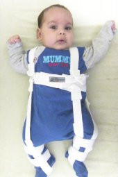 KiddoCy Pavlik Kalça Abdüksiyon Ortezi - 1