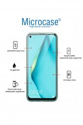 Microcase iPhone 11 Pro Max 360 Tpu Serisi Ön Arka Full Cover Şeffaf Kılıf - 2