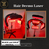 Saç Lazer Ünitesi - Hair Dermo Lazer Ünit - 3