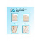 Modalucci Crystal Eraser Epilasyon Aleti, Tüy Dökücü, Tüy Silgisi, Kristal Taş Mavi - 5