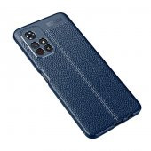 Xiaomi Redmi Note 11 5G Kılıf Focus Derili Kamera Korumalı Kılıf - 8