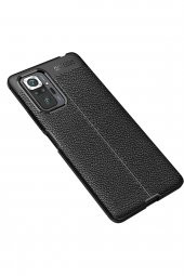 Xiaomi Redmi Note 10 Pro Kılıf Focus Derili Silikon Kılıf - 2