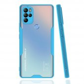 General Mobile GM 21 Pro Kılıf Platin Renkli Şık Silikon Kılıf - 5