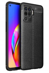 Oppo Reno 5 Lite Kılıf Focus Derili Silikon Kılıf - 1