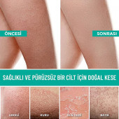Dermapeel Orta Banyo Kesesi + Pink Touch Yüz Kesesi Set - 6