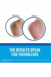 OKeeffes Healthy Feet Ayak Bakım Kremi 85GR - 3