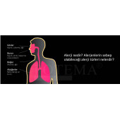 Potema Anti-Mite Akar Spreyi 330 ml Yatak Temizleme Spreyi (ev tozu akarları için özel) Mattress-Clean-Spray - 5