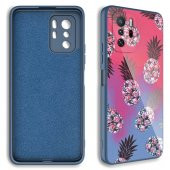 Xiaomi Redmi Note 10 Pro Kılıf Kamera Korumalı Desenli Sert Silikon Zore Epoksi Kapak - 2