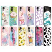 Xiaomi Redmi Note 11S Global Kılıf Kamera Korumalı Desenli Sert Silikon Zore Epoksi Kapak - 2