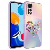 Xiaomi Redmi Note 11 Pro 5G Kılıf Kamera Korumalı Desenli Sert Silikon Zore Epoksi Kapak - 5