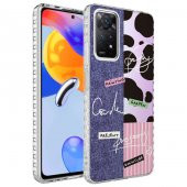 Xiaomi Redmi Note 11 Global Kılıf Airbag Kenarlı Renkli Desenli Silikon Zore Elegans Kapak - 3