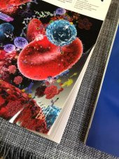 AABB Transfusion Dergisi Vol 59-5,8,9,s3 Sayıları 6 Adet thumbnail 12