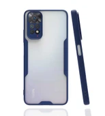 Zore Xiaomi ile uyumlu Redmi Note 11 Global Kılıf Parfe Kapak - 6