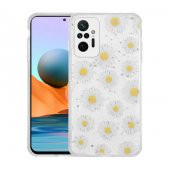 Xiaomi Redmi Note 10 Pro Kılıf Simli Desenli Kamera Korumalı Parlak Popy Kapak - 1