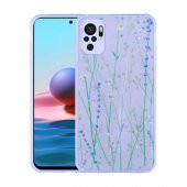 Xiaomi Redmi Note 10 Kılıf Simli Desenli Kamera Korumalı Parlak Popy Kapak - 2