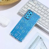 Galaxy A72 Kılıf Sidney Desenli Sert Kapak - 1