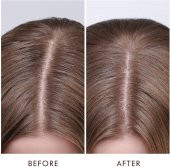Moroccanoil Dry Scalp Treatment Kuru Saç Derisi Serumu 45ML - 3