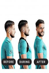 Spor Dik Duruş Korsesi Kamburluk Önleyici Yeni Nesil thumbnail 3