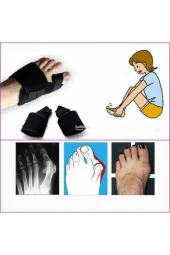 Halluks Ayak Baş Parmak Çıkıntısı Tedavisi Kemik Düzeltici Gece Ateli (çift ) thumbnail 3