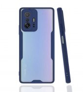 Xiaomi Mi 11T 5G Kılıf Platin Kamera Korumalı Silikon Kılıf - 5