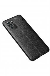 Xiaomi Redmi Note 10 Kılıf Focus Derili Silikon Kılıf - 1