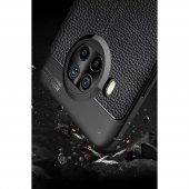 Xiaomi Redmi Note 9 Pro 5G Kılıf Focus Derili Silikon Kılıf - 2