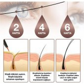 NEDOX Kaş Ve Kirpik Uzatıcı, Onarıcı, Besleyici Ve Güçlendirici Bakım Serum Garantili 5 ml - 6