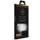 Smcase Oppo A92 Kılıf Ultra Soft Negro Karbon Silikon  Nano Ekran Koruyucu thumbnail 11