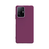 Smcase Xiaomi 11T Pro Kılıf Biye Tpu Silikon  Nano Ekran Koruyucu - 7