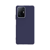 Smcase Xiaomi 11T Pro Kılıf Biye Tpu Silikon  Nano Ekran Koruyucu - 9