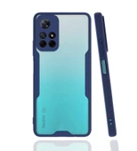 Smcase Xiaomi Redmi Note 11 5G Kılıf Kamera Korumalı Parfe Silikon - 3